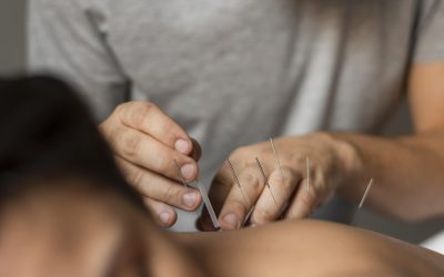 Acupuncture and Neuroplasticity: How Needling Supports Brain Health