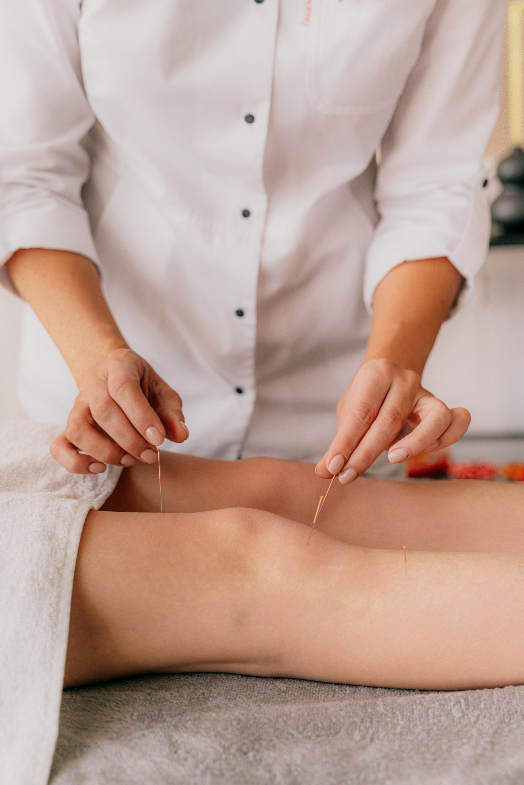 Augusta Acupuncture Clinic | Top Doctor for Toxic Exposure in Augusta