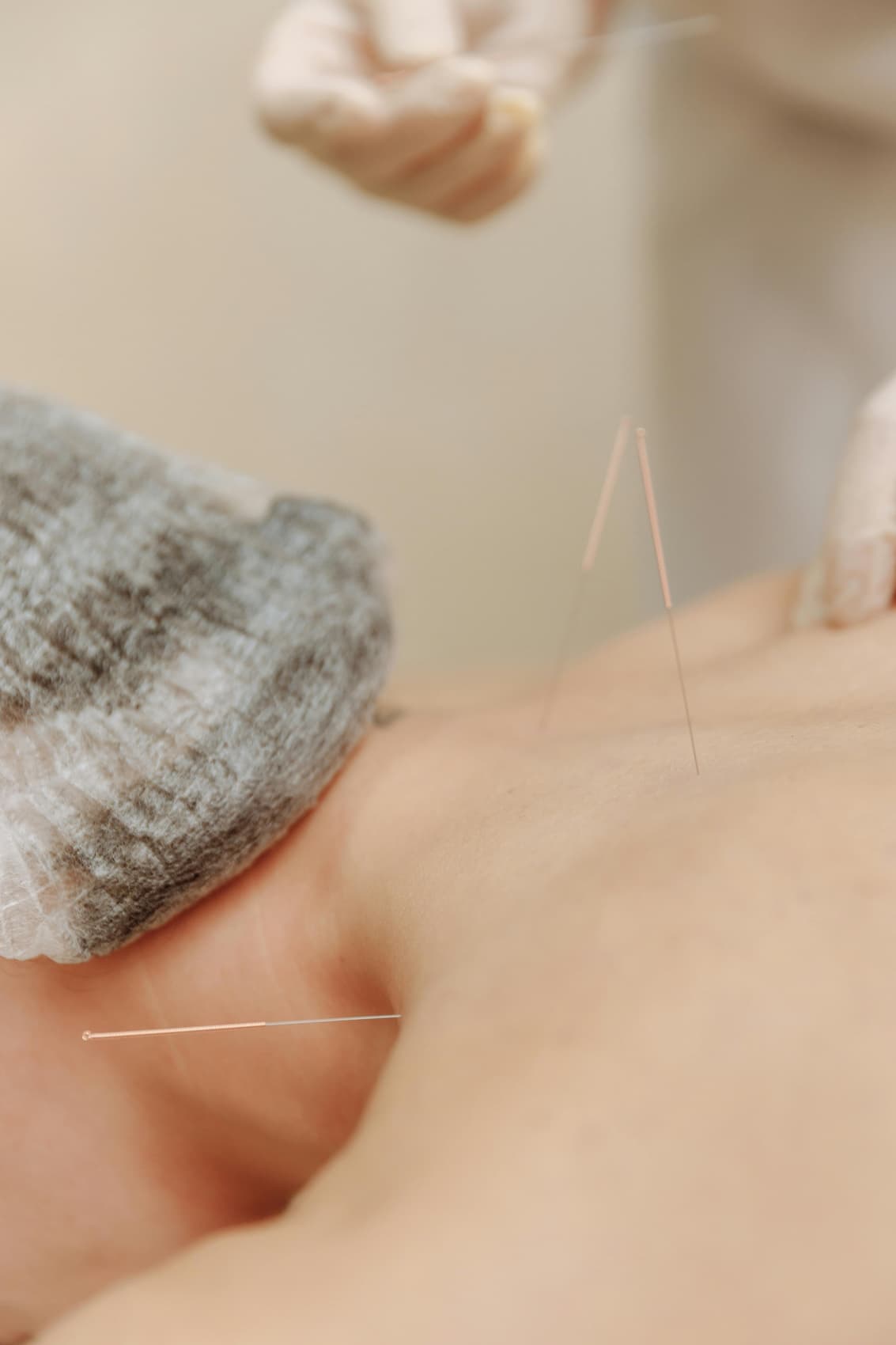 Augusta Acupuncture Clinic | Augusta’s Acupuncture Clinic for Fatigue