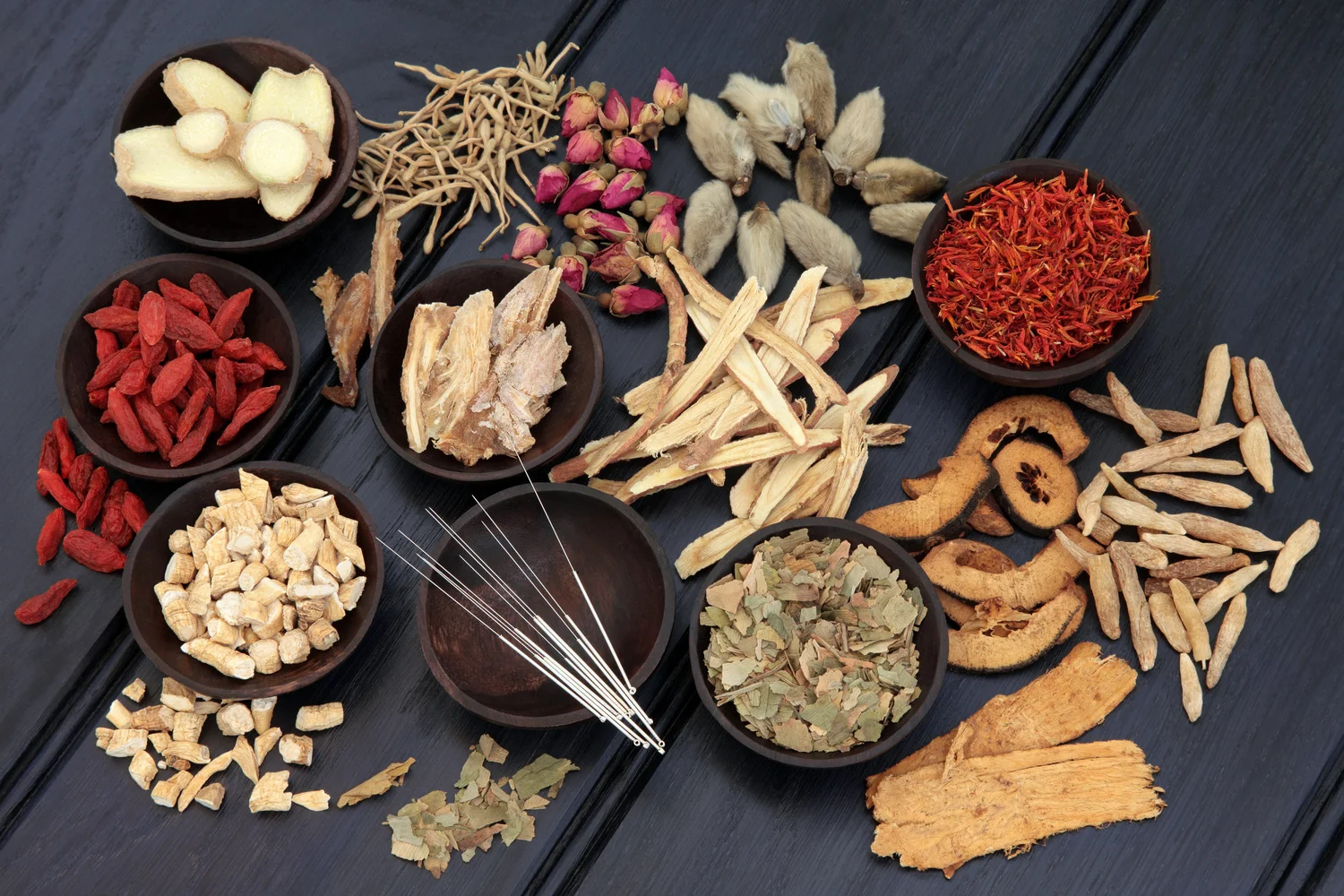 sherrell acupuncture