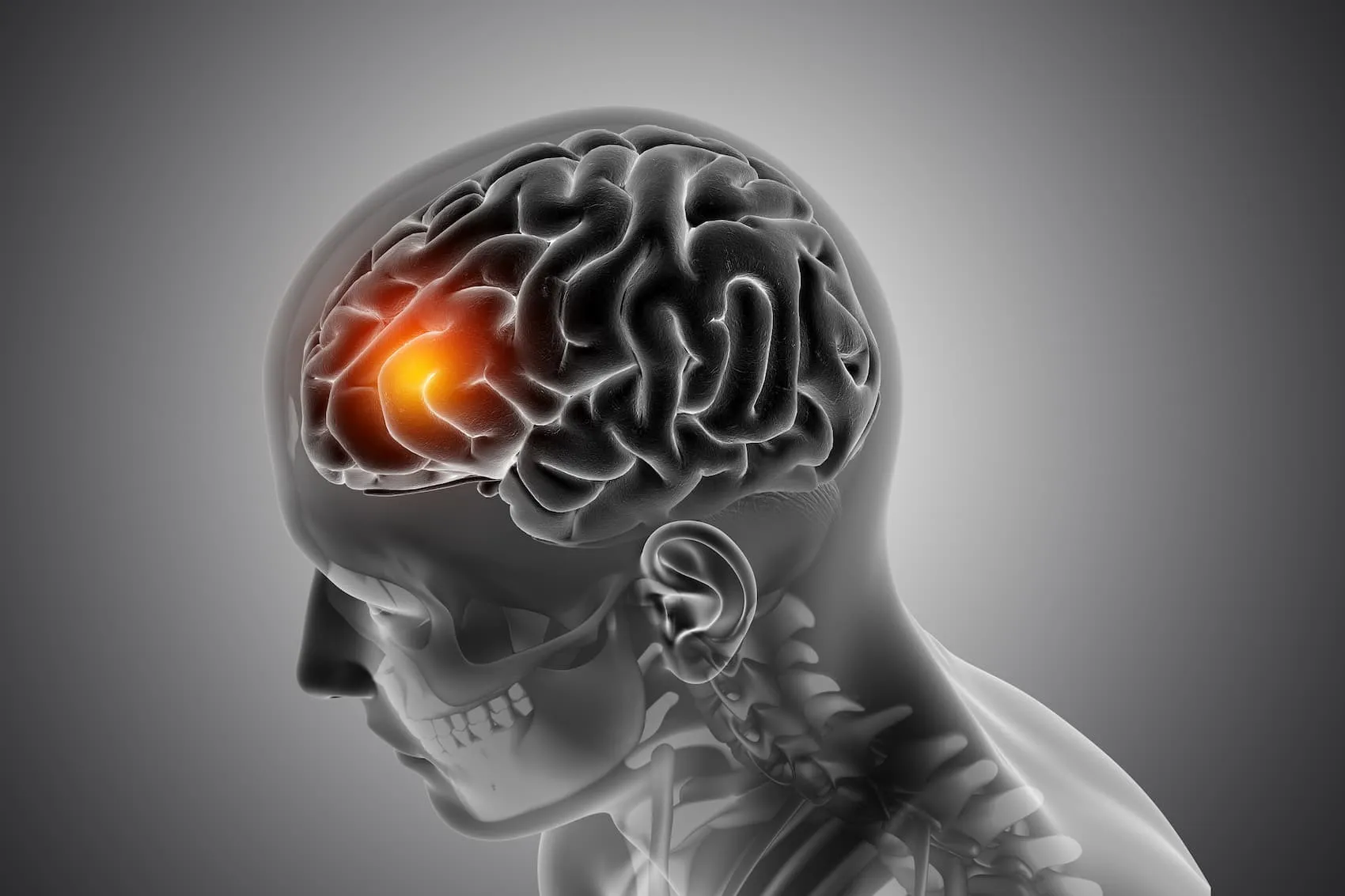 Sleep After TBI